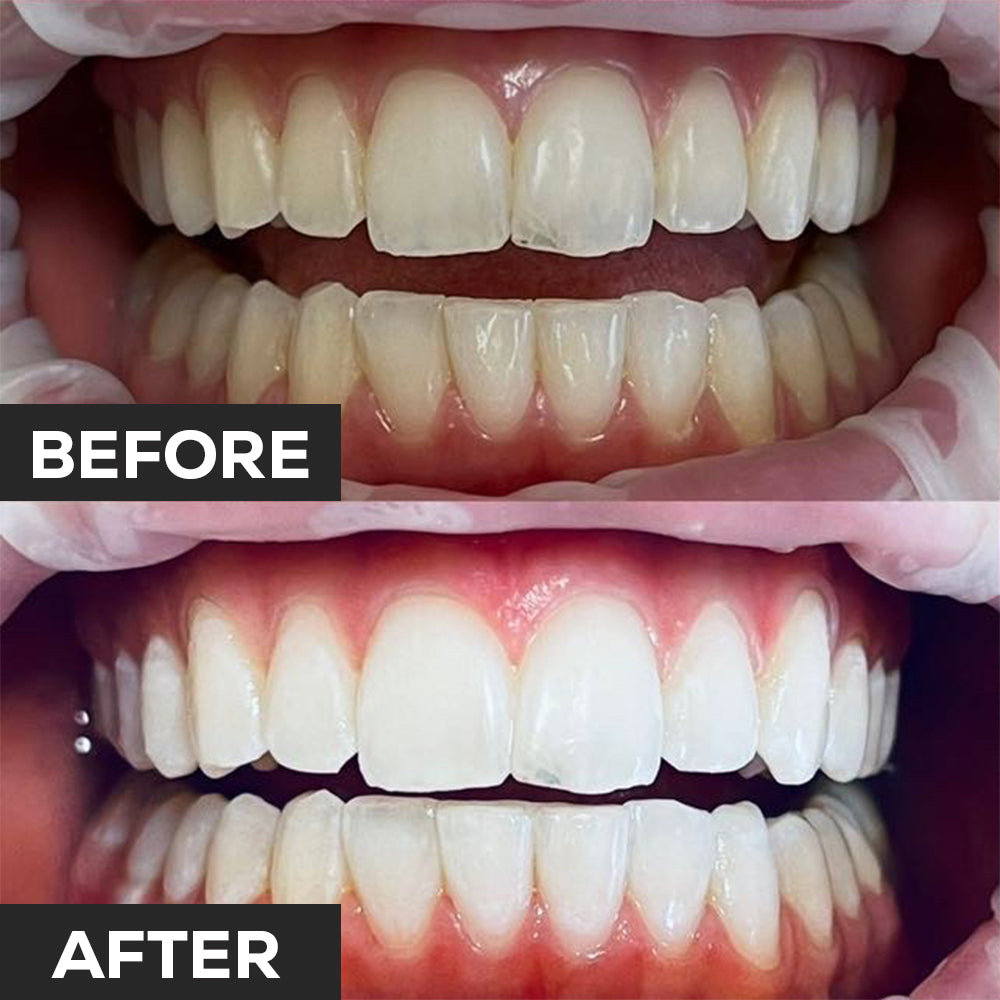 Dental Photography Tips