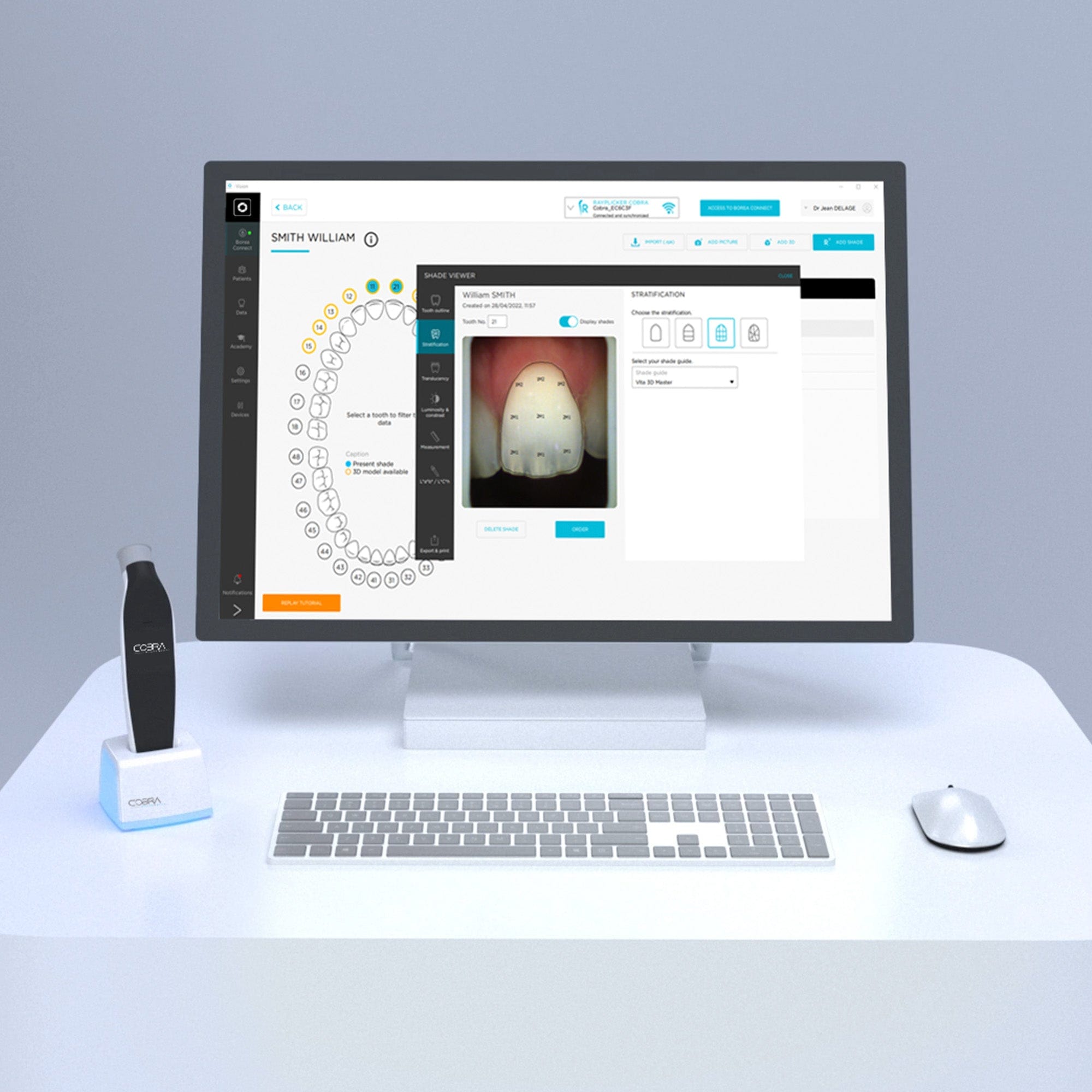 GLO Precise Shade Scanner